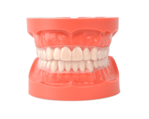 mouth with clear braces