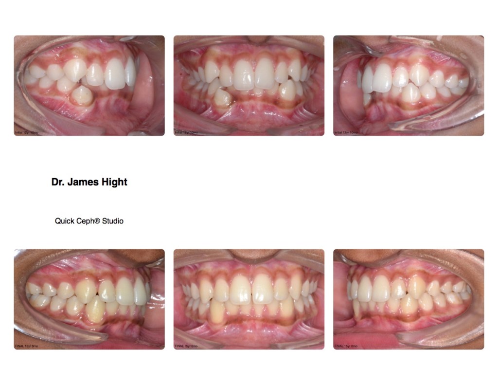 Comparison1 before and after photos