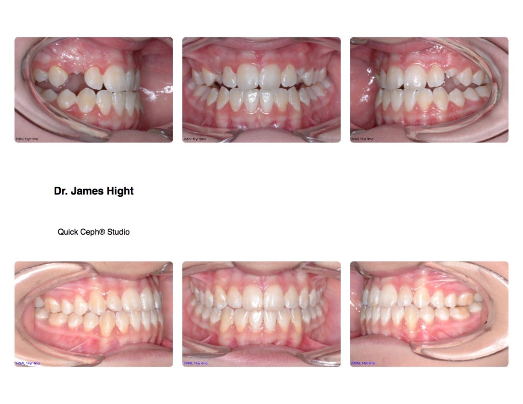 Comparison10