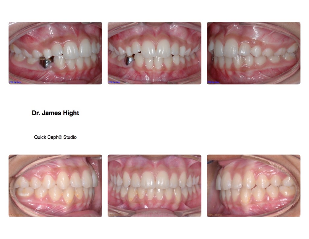 Comparison12