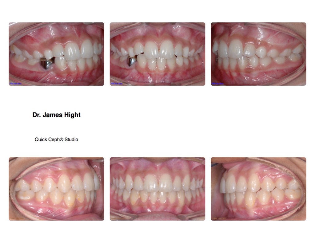 Comparison12