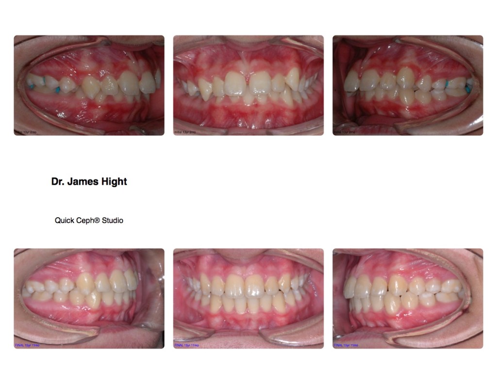 Comparison13