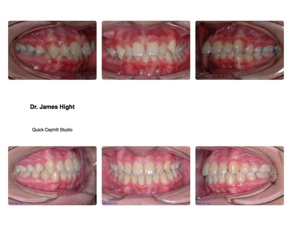 Comparison13