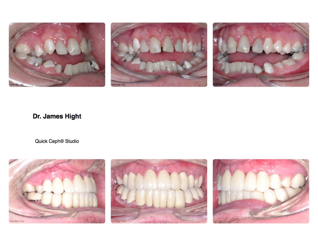 Comparison14