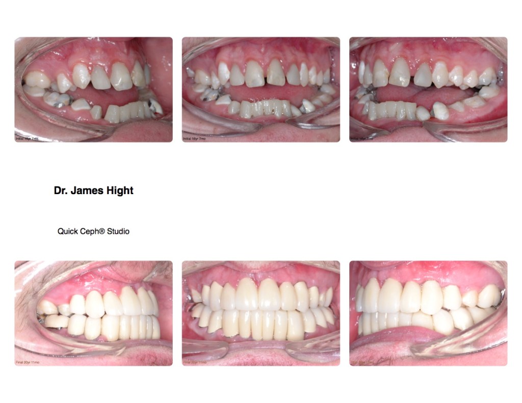 Comparison14