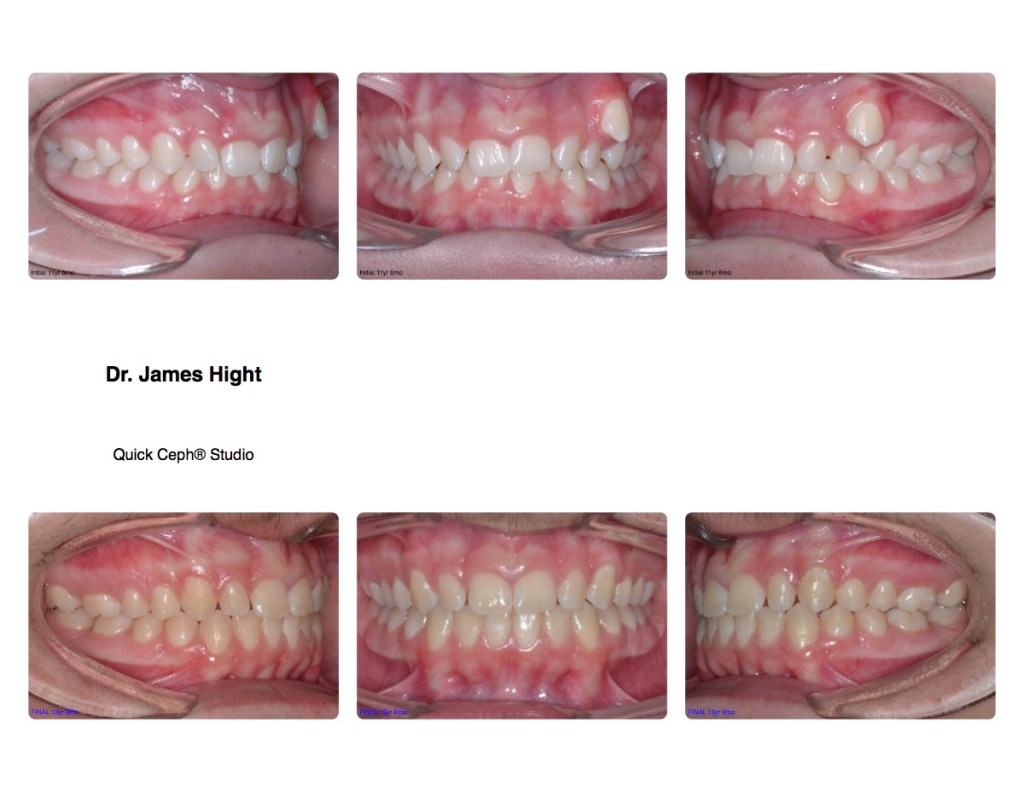 Comparison15