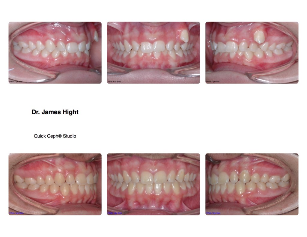 Comparison15