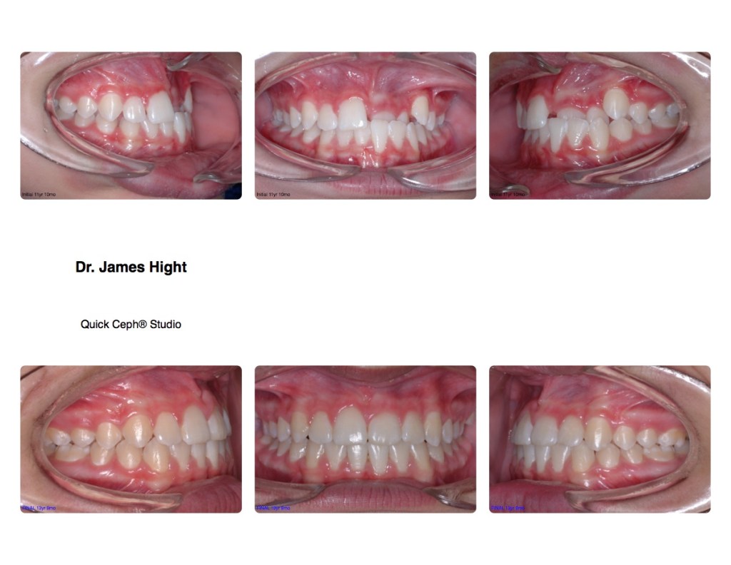 Comparison16