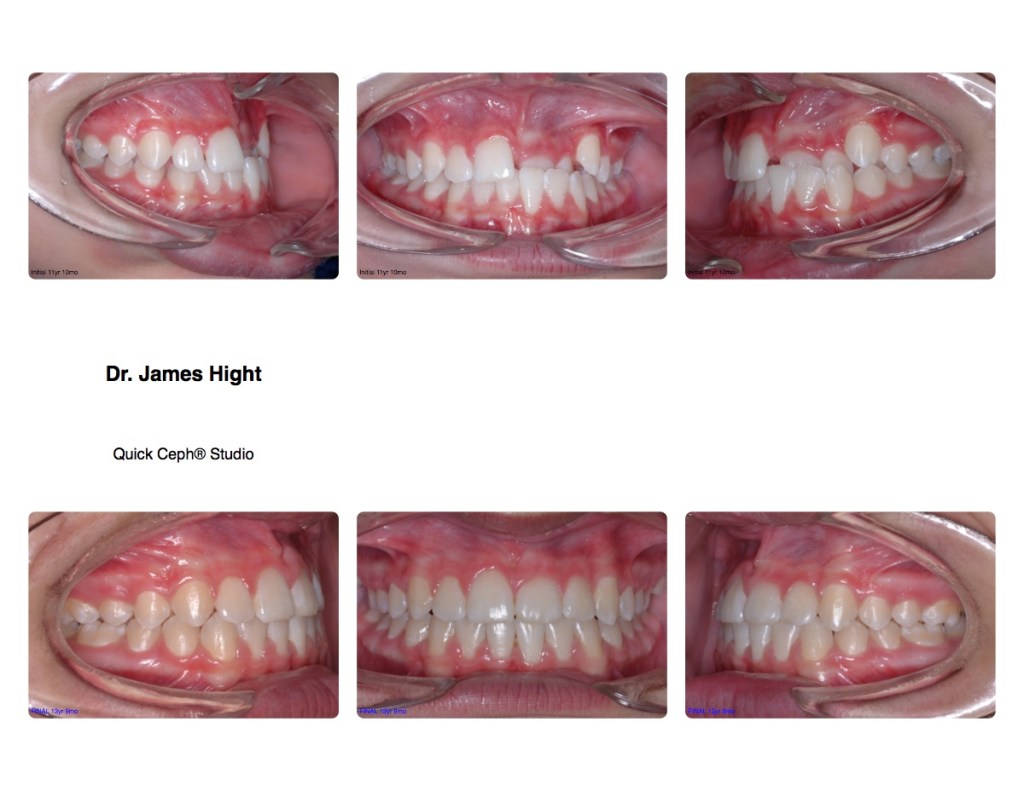 Comparison16