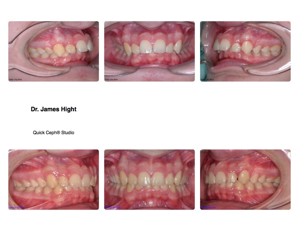 Comparison17