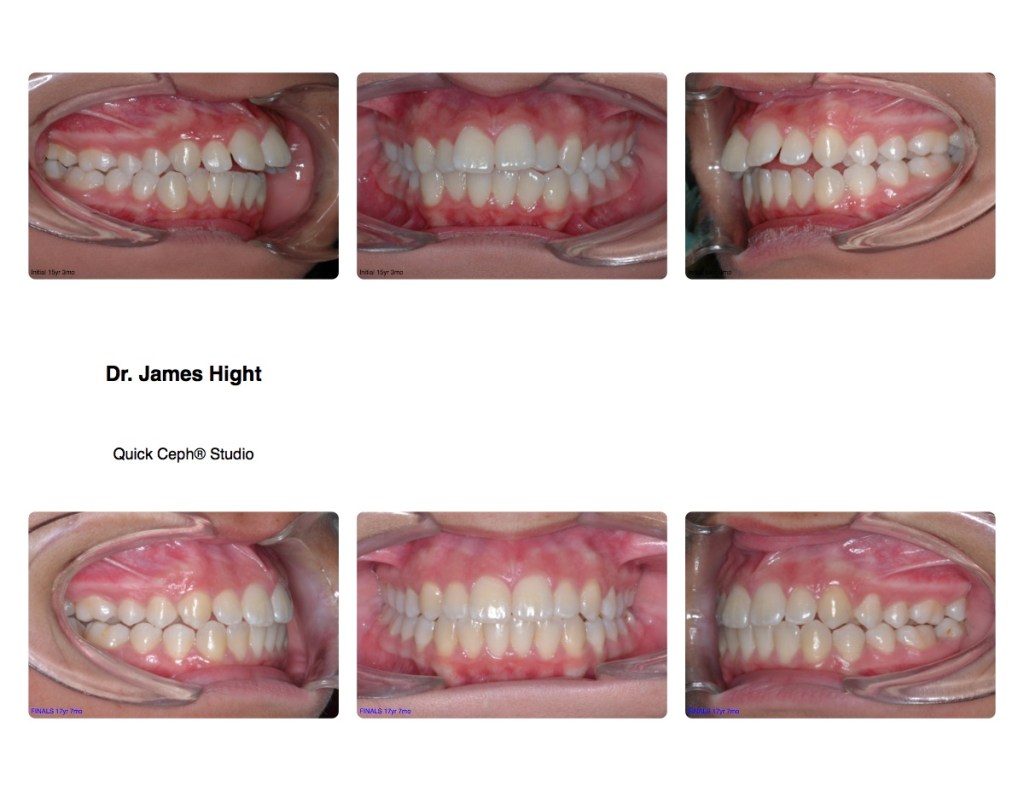 Comparison18