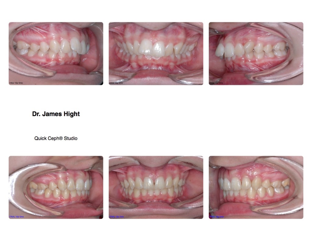 Comparison19