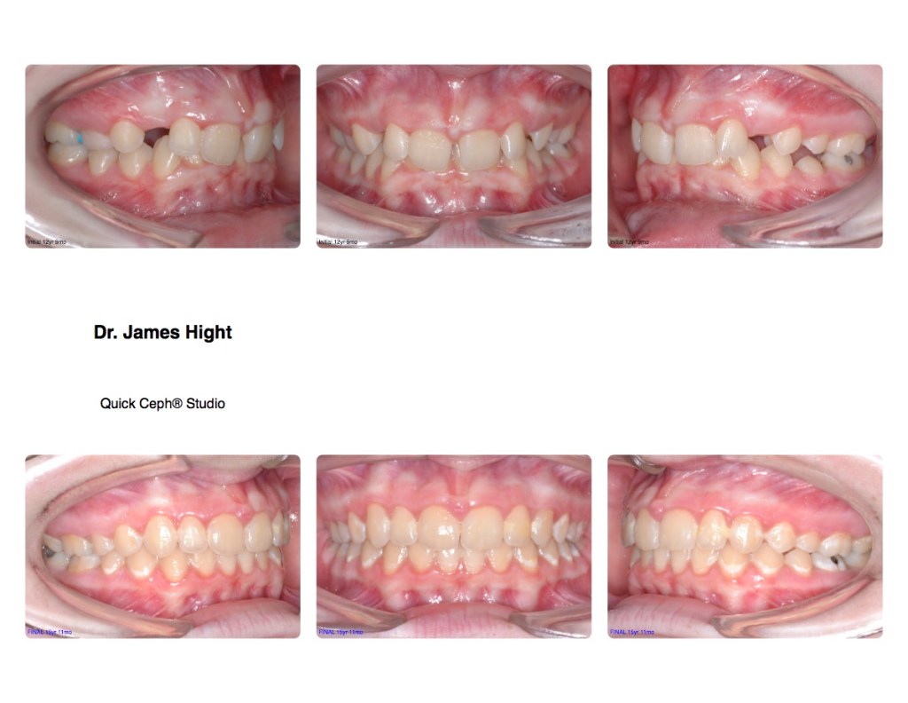 Comparison2