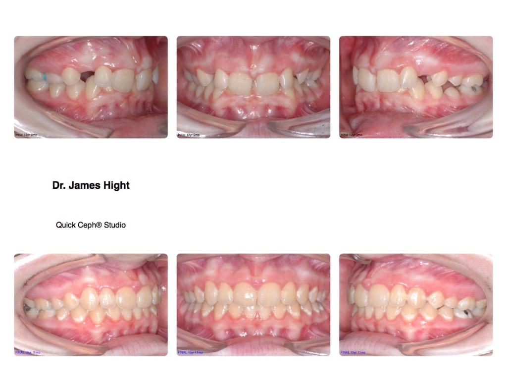 Comparison2
