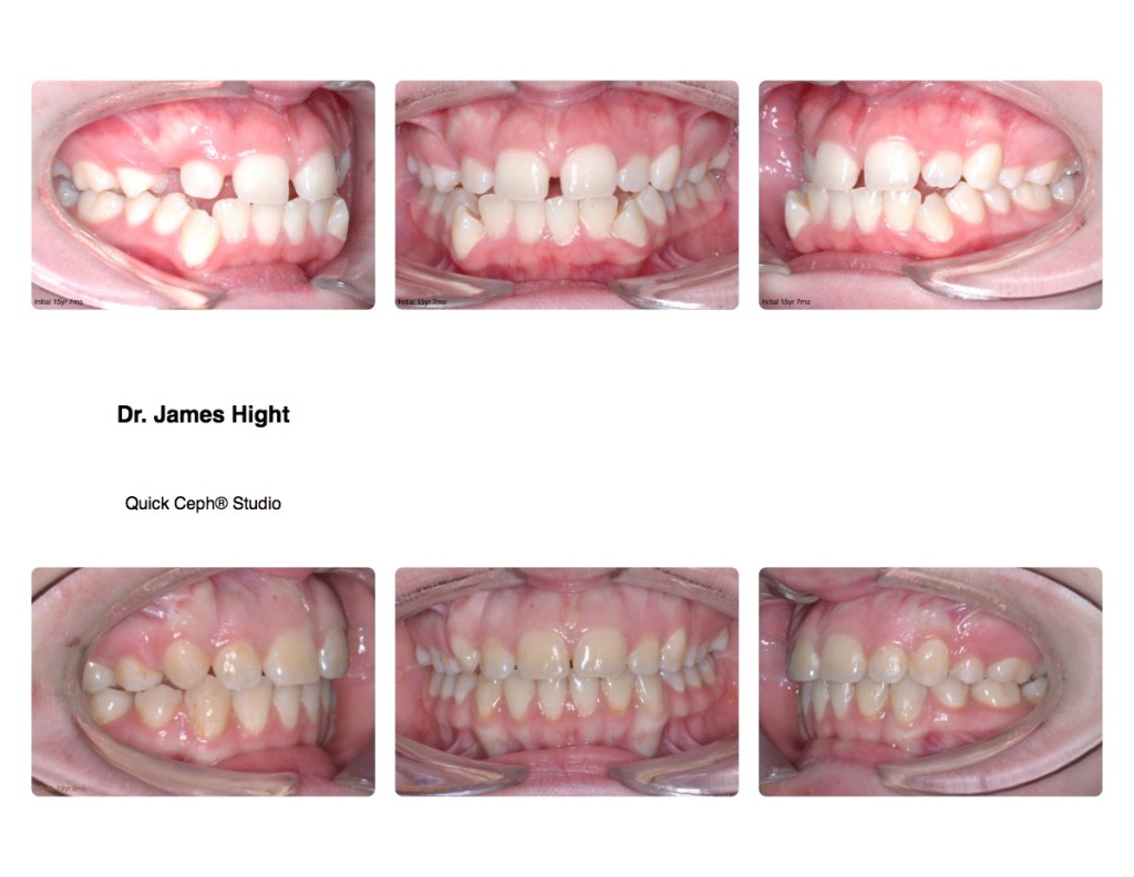 Comparison22