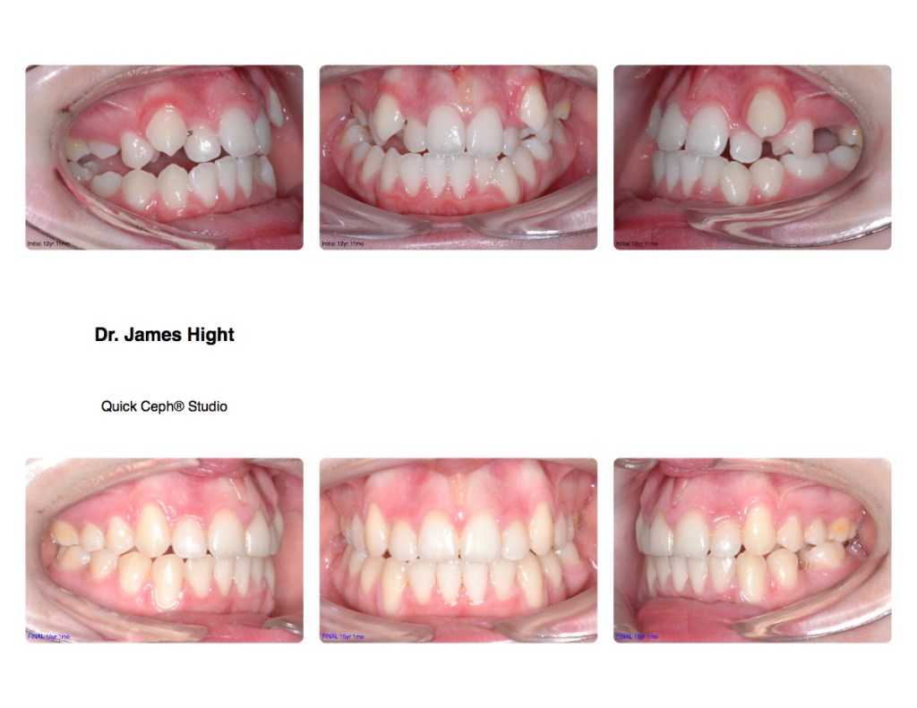Comparison26