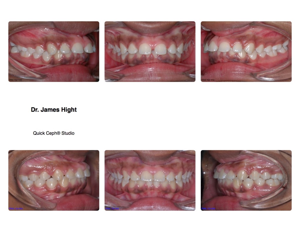 Comparison27