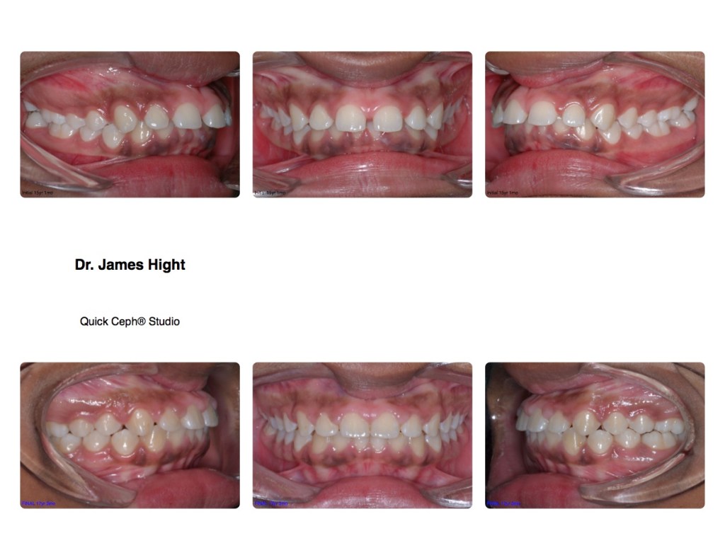 Comparison27