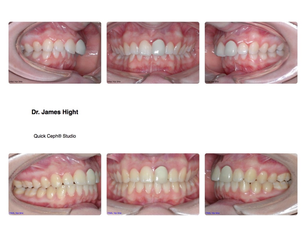 Comparison28-trail