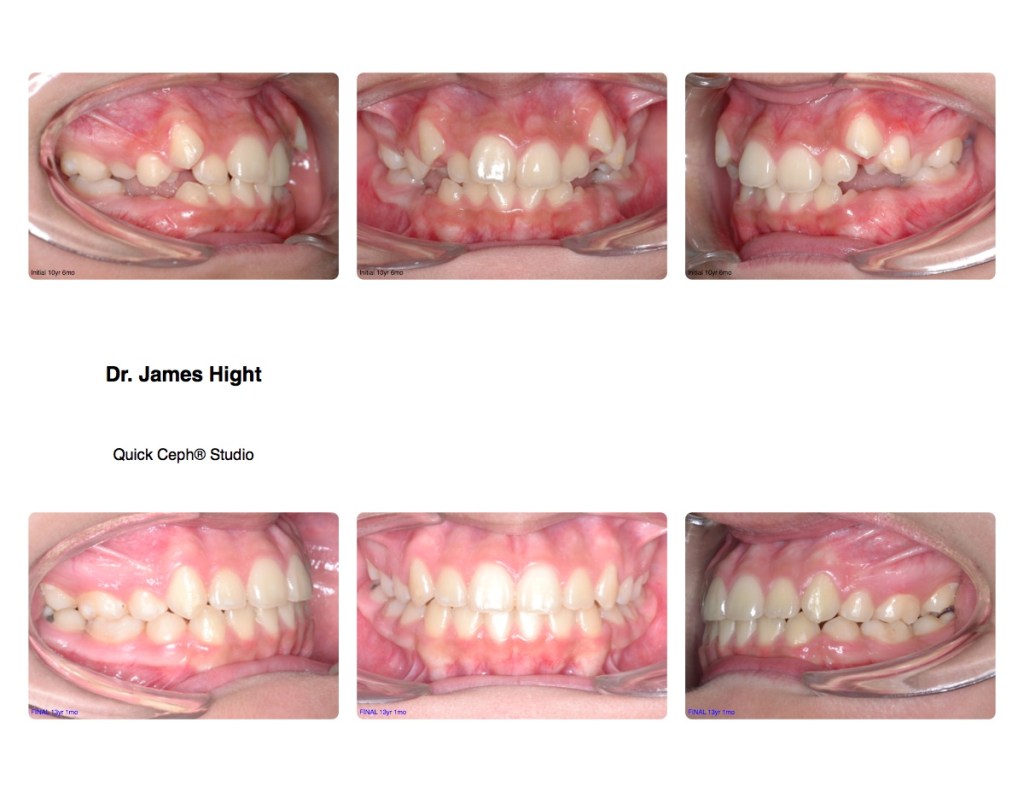 Comparison3