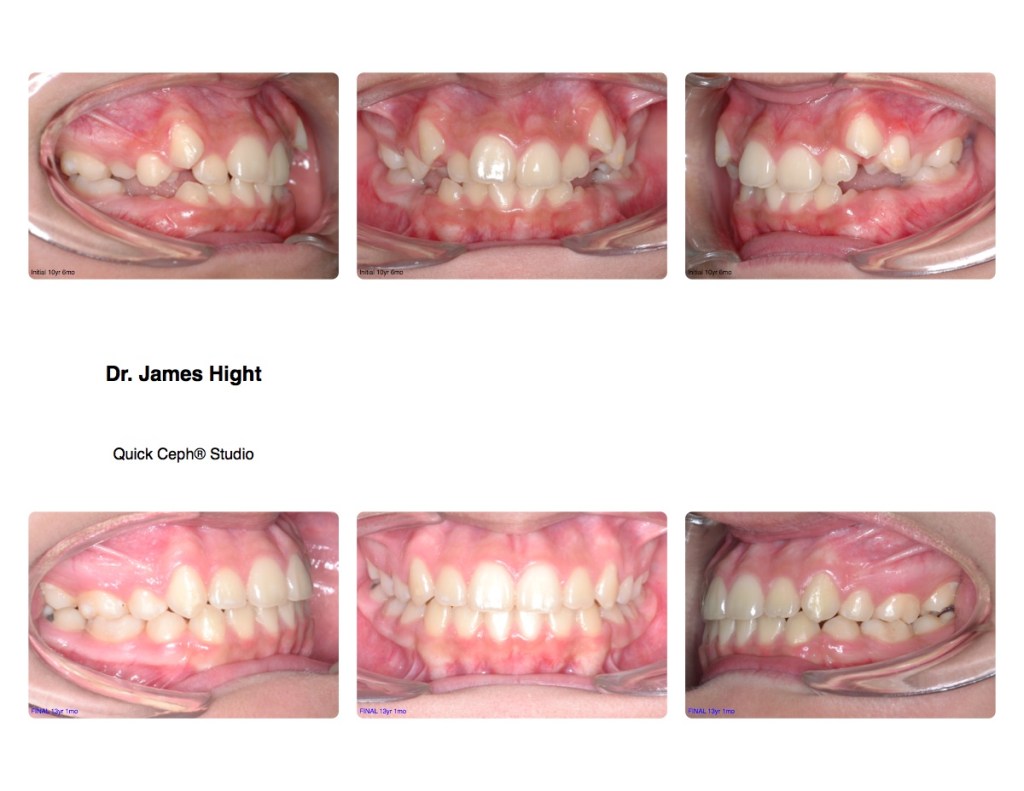 Comparison3