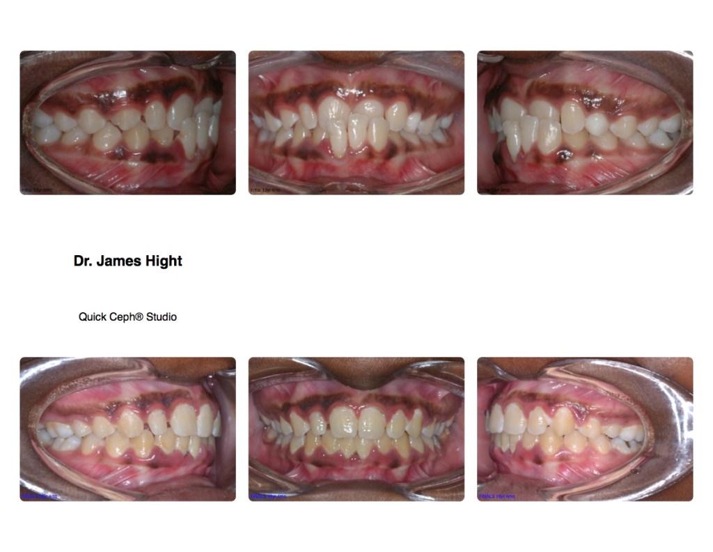 Comparison33