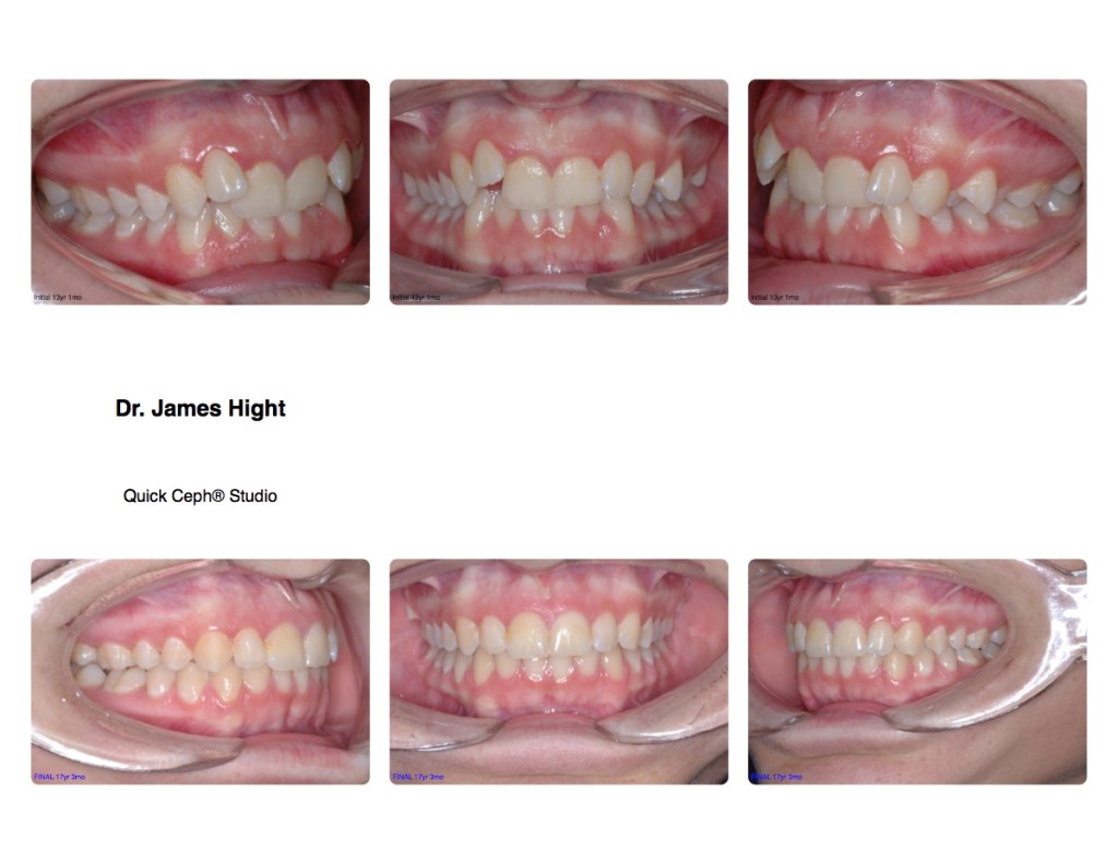 Comparison36