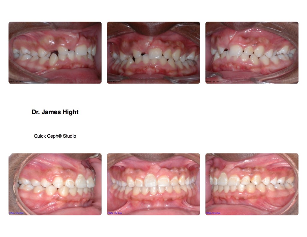 Comparison4