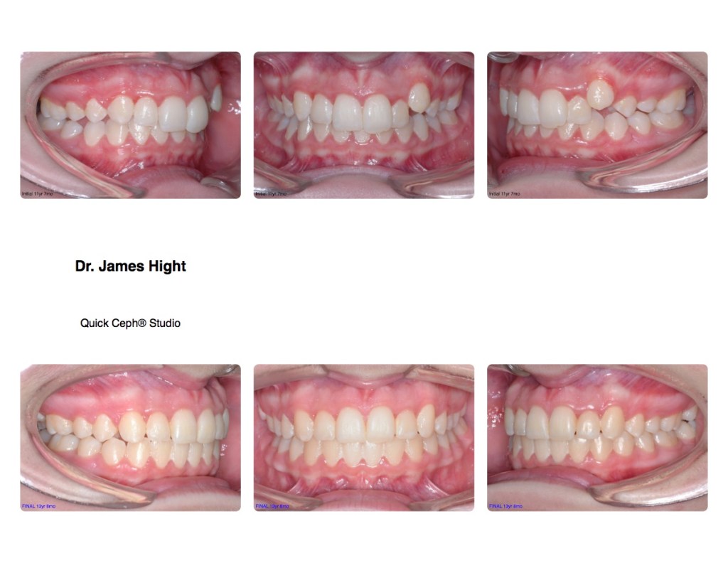 Comparison5