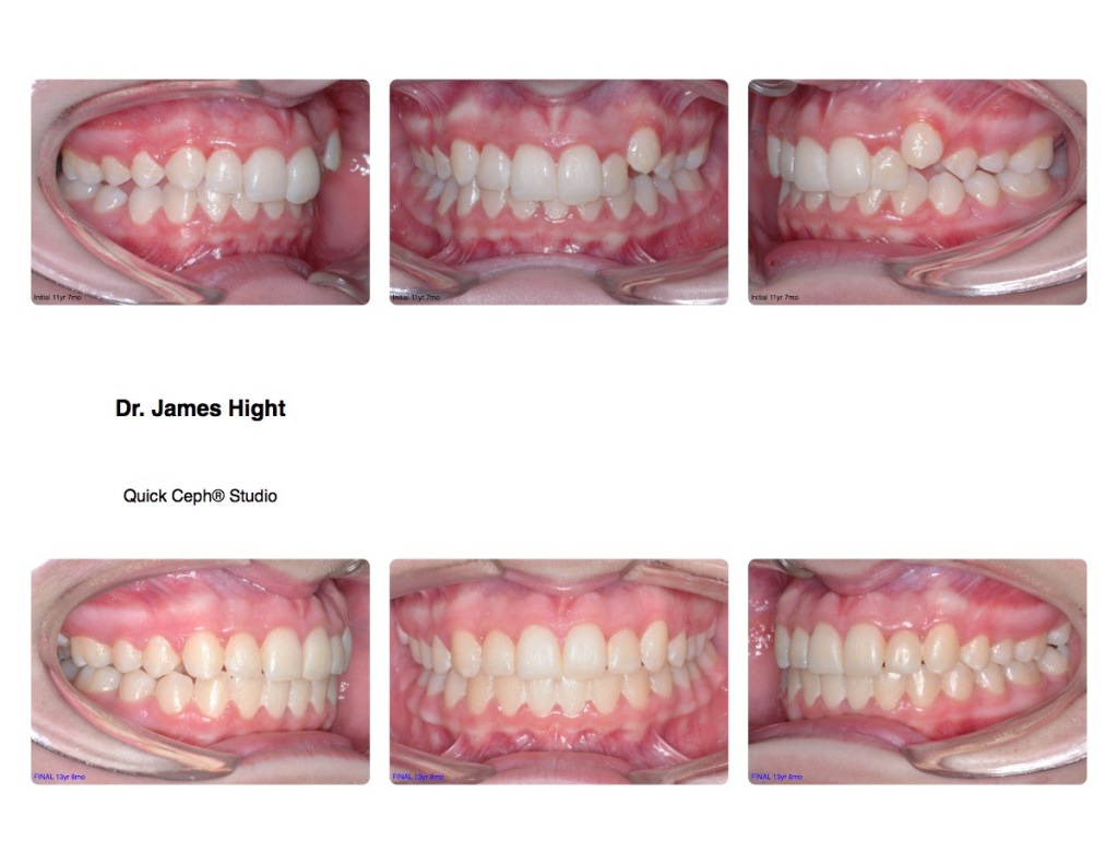 Comparison5