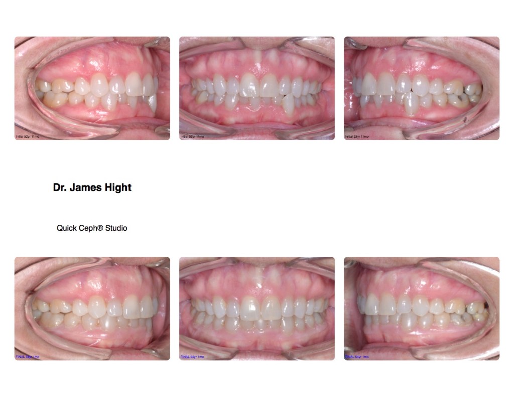 Comparison6