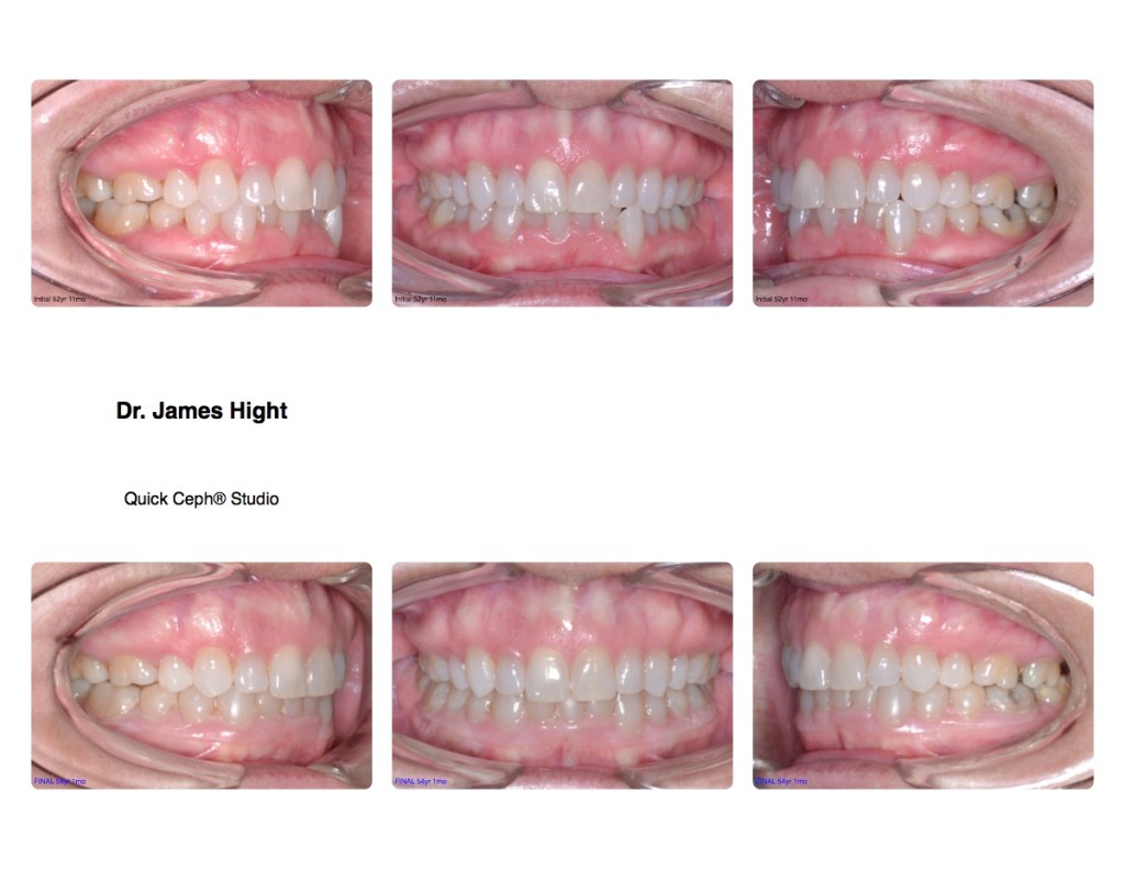 Comparison6