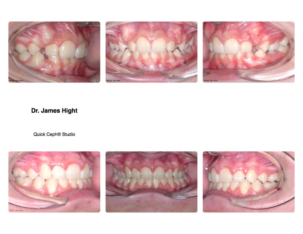 Comparison9