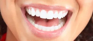 smiling girl with clear braces